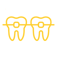 What are clear ceramic braces? 2 Clear ceramic braces