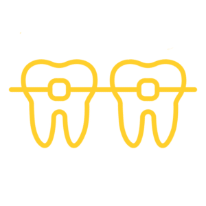 Should you consider self litigating braces? 2 Damon braces self litigating braces